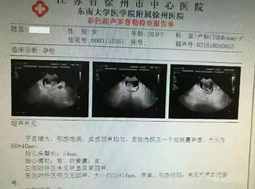 Pregnant 1